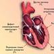 Принципи лікування кардіогенного шоку