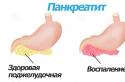 Запалення підшлункової залози що робити Запалення підшлункової залози симптоми лікування
