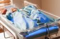 Kako se bilirubin brzo smanjuje kod novorođenčadi pod lampom