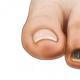 Чому синіють нігті: причини захворювання